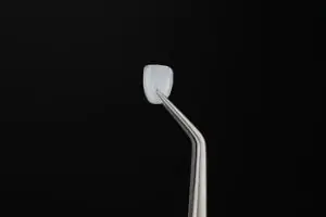 Veneers Australia porcelain chatswood